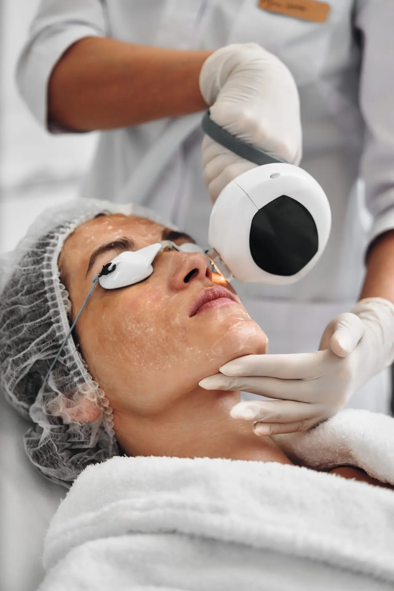 Laser Treatments